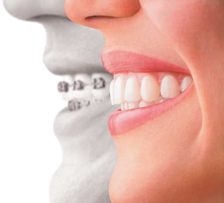 telsiz-ortodonti.jpg